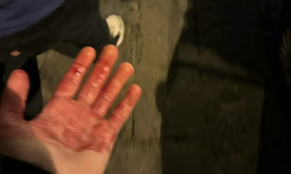 Tifosi del Chelsea aggrediti nella notte a Napoli: il club londinese lancia l’allarme