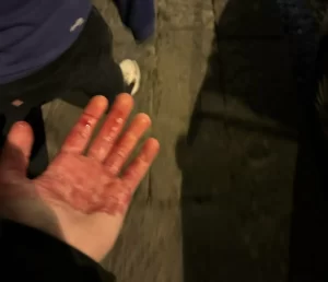 Tifosi del Chelsea aggrediti nella notte a Napoli: il club londinese lancia l’allarme