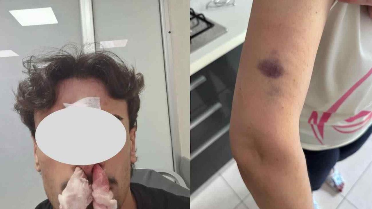 Casoria, aggressione in casa per un parcheggio disabili: madre racconta l’episodio