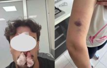 Casoria, aggressione in casa per un parcheggio disabili: madre racconta l’episodio