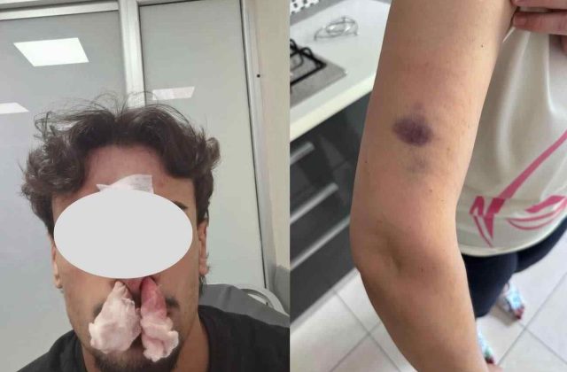 Casoria, aggressione in casa per un parcheggio disabili: madre racconta l’episodio