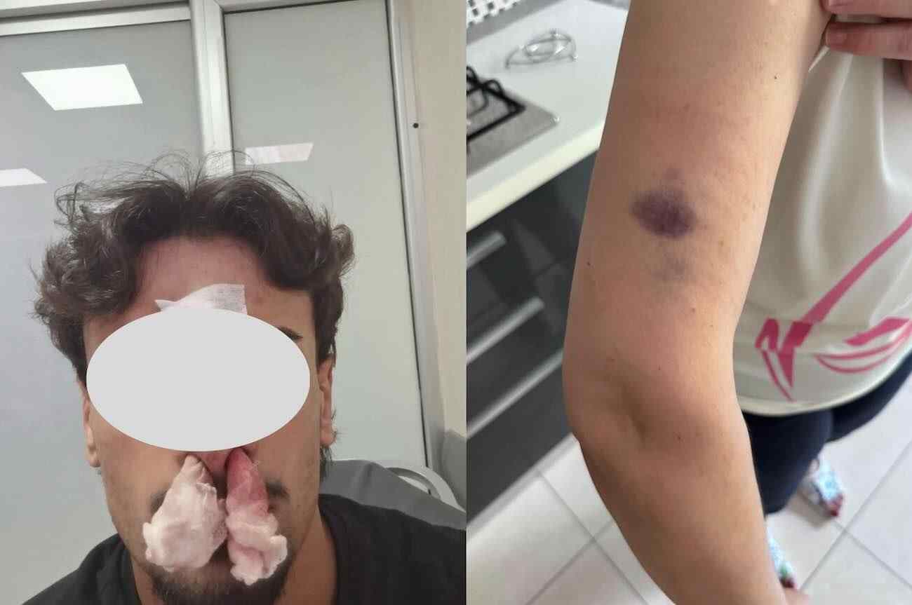 Casoria, aggressione in casa per un parcheggio disabili: madre racconta l’episodio